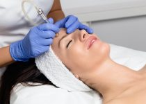 microdermabrasion in Lexington, KY