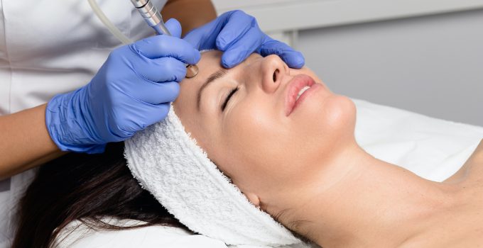 microdermabrasion in Lexington, KY